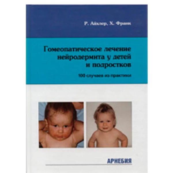 Гомеопатическое лечение нейродермита у детей и подростков, Айхлер Р., Франк Х.